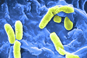  Da Bakterien in einem nicht kultivierbaren Zustand (VBNC) im Biofilm unentdeckt bleiben können, ist bei konkreten Prädikatoren die mikroskopische Auszählung der Gesamtzellzahl zu empfehlen. 
