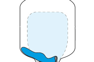  Bei Sackmembranen droht, z.B. bei nicht exakter vertikaler Montage, ein Umklappen der Membran. Wasser kann in der Membran eingeschlossen werden – eine hygienisch heikle Situation. 