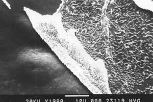  Junger, dünner Biofilm auf der inneren Oberfläche eines Silikonschlauchs, bei dem die stäbchenförmige Bakterien sehr gut erkennbar sind 